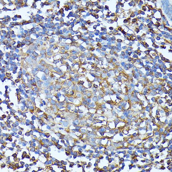 CXCR1 Antibody - Immunohistochemistry of paraffin-embedded Human colon using CXCR1 Polyclonal Antibody at dilution of 1:100 (40x lens).