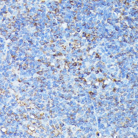 CXCR1 Antibody - Immunohistochemistry of paraffin-embedded Mouse spleen using CXCR1 Polyclonal Antibody at dilution of 1:100 (40x lens).