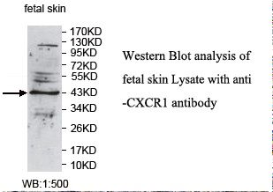 CXCR1 Antibody