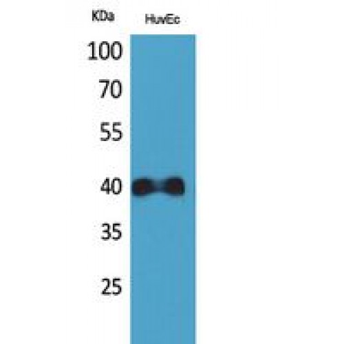 CXCR2 Antibody - Western blot of IL8Rbeta antibody
