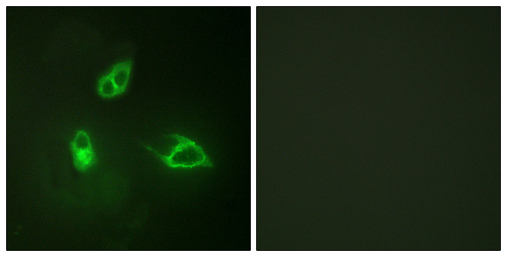 CXCR2 Antibody - Immunofluorescence analysis of HepG2 cells, using IL-8R beta/CDw128 beta Antibody. The picture on the right is blocked with the synthesized peptide.