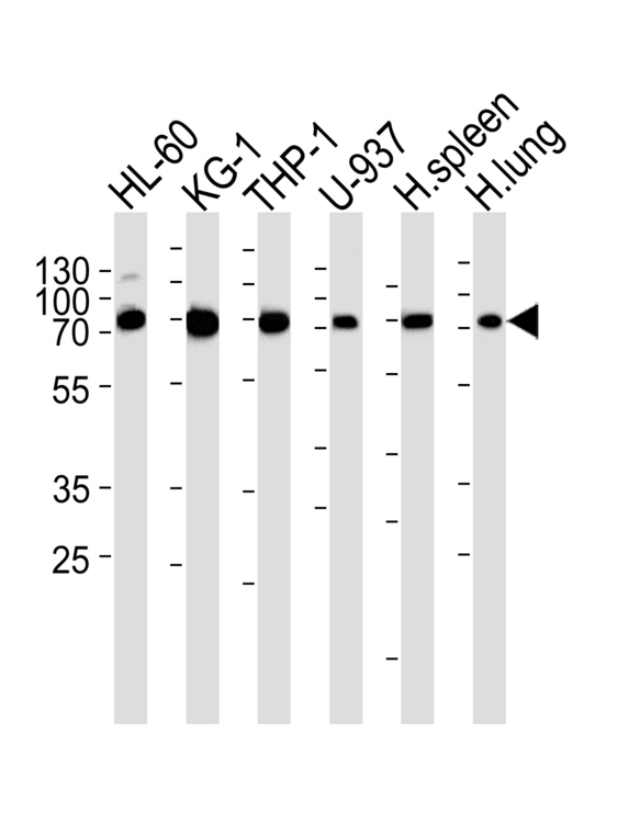 CXCR2 Antibody - Western blot of lysates from HL-60, KG-1, THP-1, U-937 cell line , human spleen and lung tissue lysate (from left to right) with IL8RB Antibody. Antibody was diluted at 1:1000 at each lane. A goat anti-rabbit IgG H&L (HRP) at 1:5000 dilution was used as the secondary antibody. Lysates at 35 ug per lane.