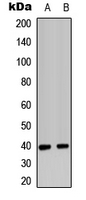 CXCR2 Antibody - Western blot analysis of CD182 expression in HeLa (A); HL60 (B) whole cell lysates.