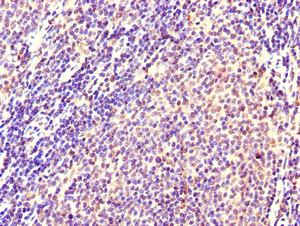 CXCR2 Antibody - Immunohistochemistry of paraffin-embedded human lymph node tissue using CXCR2 Antibody at dilution of 1:100
