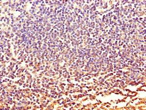 CXCR2 Antibody - Immunohistochemistry of paraffin-embedded human tonsil tissue using CXCR2 Antibody at dilution of 1:100