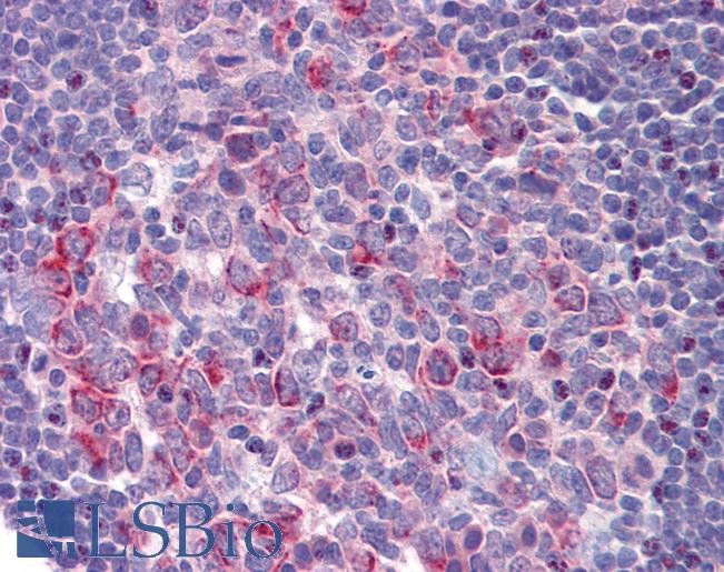 CXCR2 Antibody - Anti-CXCR2 antibody IHC of human tonsil. Immunohistochemistry of formalin-fixed, paraffin-embedded tissue after heat-induced antigen retrieval. Antibody concentration 5 ug/ml.  This image was taken for the unconjugated form of this product. Other forms have not been tested.