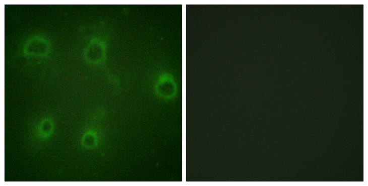CXCR2 Antibody - Immunofluorescence analysis of COS7 cells, using IL-8R beta/CDw128 beta (Phospho-Ser347) Antibody. The picture on the right is blocked with the phospho peptide.