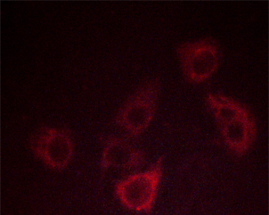 CXCR2 Antibody - Staining COS7 cells by IF/ICC. The samples were fixed with PFA and permeabilized in 0.1% saponin prior to blocking in 10% serum for 45 min at 37°C. The primary antibody was diluted 1/400 and incubated with the sample for 1 hour at 37°C. A Alexa Fluor 594 conjugated goat polyclonal to rabbit IgG (H+L), diluted 1/600 was used as secondary antibody.