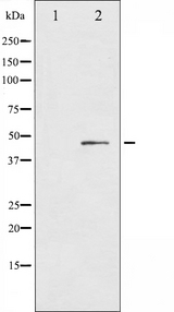 CXCR2 Antibody - Western blot analysis of IL-8R beta/CDw128 beta phosphorylation expression in PMA treated NIH-3T3 whole cells lysates. The lane on the left is treated with the antigen-specific peptide.