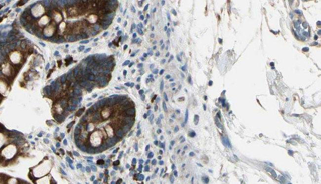 CXCR2 Antibody - 1:100 staining mouse intestine tissue by IHC-P. The sample was formaldehyde fixed and a heat mediated antigen retrieval step in citrate buffer was performed. The sample was then blocked and incubated with the antibody for 1.5 hours at 22°C. An HRP conjugated goat anti-rabbit antibody was used as the secondary.