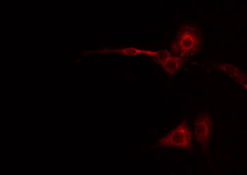 CXCR2 Antibody - Staining NIH-3T3 cells by IF/ICC. The samples were fixed with PFA and permeabilized in 0.1% Triton X-100, then blocked in 10% serum for 45 min at 25°C. The primary antibody was diluted at 1:200 and incubated with the sample for 1 hour at 37°C. An Alexa Fluor 594 conjugated goat anti-rabbit IgG (H+L) Ab, diluted at 1/600, was used as the secondary antibody.