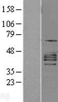 CXCR2 Protein - Western validation with an anti-DDK antibody * L: Control HEK293 lysate R: Over-expression lysate