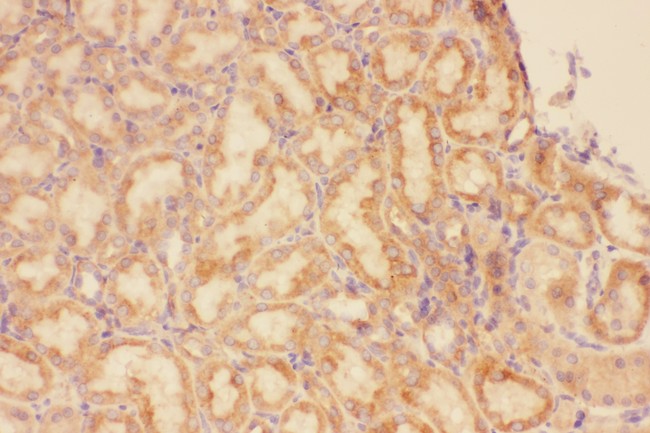 CXCR3 Antibody - CXCR3 antibody IHC-paraffin: Rat Kidney Tissue.