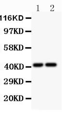 CXCR3 Antibody - CXCR3 antibody Western blot. All lanes: Anti-CXCR3 at 0.5 ug/ml. Lane 1: Colo320 Whole Cell Lysate at 40 ug. Lane 2: SGC Whole Cell Lysate at 40 ug. Predicted band size: 41 kD. Observed band size: 41 kD.