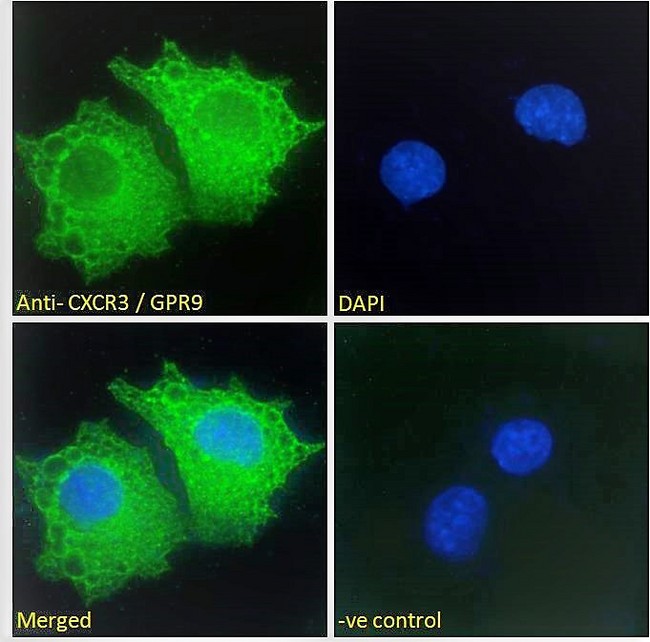 CXCR3 Antibody - Goat Anti-CXCR3 / GPR9 Antibody Immunofluorescence analysis of paraformaldehyde fixed HepG2 cells, permeabilized with 0.15% Triton. Primary incubation 1hr (10ug/ml) followed by Alexa Fluor 488 secondary antibody (2ug/ml), showing membrane staining. The nuclear stain is DAPI (blue). Negative control: Unimmunized goat IgG (10ug/ml) followed by Alexa Fluor 488 secondary antibody (2ug/ml).