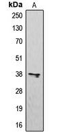 CXCR3 Antibody - Western blot analysis of CD183 expression in K562 (A) whole cell lysates.