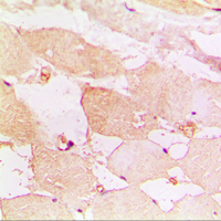 CXCR3 Antibody - Immunohistochemical analysis of CD183 staining in human muscle formalin fixed paraffin embedded tissue section. The section was pre-treated using heat mediated antigen retrieval with sodium citrate buffer (pH 6.0). The section was then incubated with the antibody at room temperature and detected using an HRP conjugated compact polymer system. DAB was used as the chromogen. The section was then counterstained with hematoxylin and mounted with DPX.
