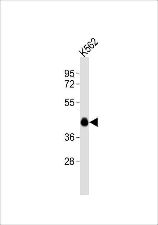 CXCR3 Antibody - Anti-CD183 Antibody at 1:1000 dilution + K562 whole cell lysates Lysates/proteins at 20 ug per lane. Secondary Goat Anti-Rabbit IgG, (H+L),Peroxidase conjugated at 1/10000 dilution Predicted band size : 41,46,29 kDa Blocking/Dilution buffer: 5% NFDM/TBST.