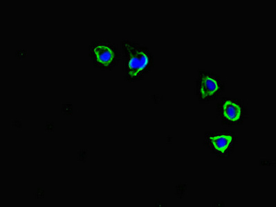 CXCR3 Antibody - Immunofluorescent analysis of HepG2 cells diluted at 1:100 and Alexa Fluor 488-congugated AffiniPure Goat Anti-Rabbit IgG(H+L)