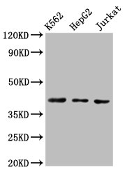 CXCR3 Antibody - Western Blot Positive WB detected in:K562 whole cell lysate, HepG2 whole cell lysate, Jurkat whole cell lysate All Lanes:CXCR3 antibody at 3µg/ml Secondary Goat polyclonal to rabbit IgG at 1/50000 dilution Predicted band size: 41,46,29 KDa Observed band size: 41 KDa