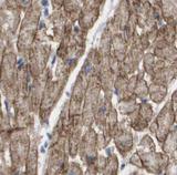 CXCR3 Antibody - Immunohistochemistry of paraffin-embedded mouse heart using CXCR3 antibody at dilution of 1:100