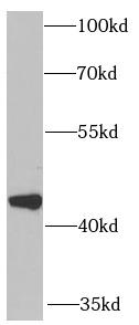 CXCR3 Antibody - K562 cells were subjected to SDS PAGE followed by western blot with CXCR3 antibody at dilution of 1:1000