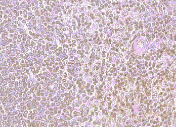 CXCR4 Antibody - Immunohistochemistry of paraffin-embeddedi human spleen stained with Goat anti-Human CD184 (N-terminal)
