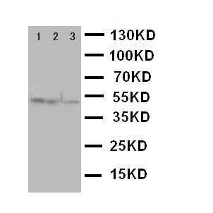 CXCR4 Antibody - WB of CXCR4 antibody. Lane 1: M231 Cell Lysate. Lane 2: MCF-7 Cell Lysate. Lane 3: JURKAT Cell Lysate.