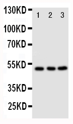 CXCR4 Antibody - Anti-CXCR4 antibody, Western blotting Lane 1: M231 Cell LysateLane 2: MCF-7 Cell LysateLane 3: JURKAT Cell Lysate