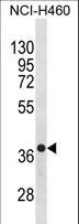 CXCR4 Antibody - CXCR4 Antibody western blot of NCI-H460 cell line lysates (35 ug/lane). The CXCR4 antibody detected the CXCR4 protein (arrow).