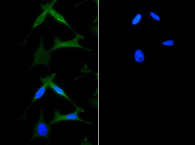 CXCR4 Antibody - Immunocytochemistry/Immunofluorescence: CXCR4 Antibody - CXCR4 antibody was tested in HeLa cells with FITC (green). Nuclei were counterstained with DAPI (blue).