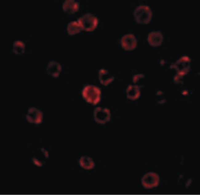 CXCR4 Antibody - Immunofluorescence of CXCR4 in HeLa cells with CXCR4 antibody at 20 ug/ml.