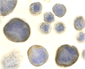 CXCR4 Antibody - Immunocytochemistry of CXCR4 in HeLa cells with CXCR4 antibody at 2 µg/ml.