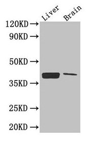 CXCR4 Antibody - Western Blot Positive WB detected in: Mouse liver, Mouse brain All lanes: CXCR4 antibody at 2.6µg/ml Secondary Goat polyclonal to rabbit IgG at 1/50000 dilution Predicted band size: 40, 41 kDa Observed band size: 40 kDa