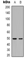 CXCR4 Antibody - Western blot analysis of CD184 expression in HeLa (A); rat brain (B) whole cell lysates.