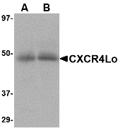 CXCR4 Antibody - Western blot of CXCR4 in (A) human spleen and (B) human thymus tissue lysate with CXCR4-Lo antibody at 10 ug/ml.