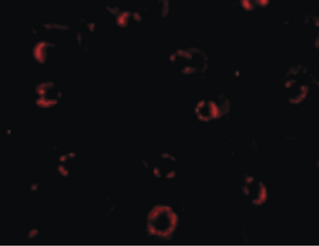 CXCR4 Antibody - Immunofluorescence of CXCR4-Lo in HeLa cells with CXCR4-Lo antibody at 4 ug/ml.