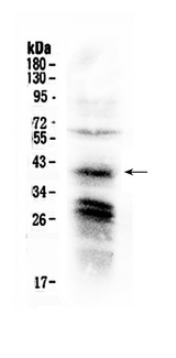 CXCR4 Antibody - Western blot analysis of CXCR4 using anti-CXCR4 antibody. Electrophoresis was performed on a 5-20% SDS-PAGE gel at 70V (Stacking gel) / 90V (Resolving gel) for 2-3 hours. The sample well of each lane was loaded with 50ug of sample under reducing conditions. Lane 1: HELA whole Cell lysates. After Electrophoresis, proteins were transferred to a Nitrocellulose membrane at 150mA for 50-90 minutes. Blocked the membrane with 5% Non-fat Milk/ TBS for 1.5 hour at RT. The membrane was incubated with rabbit anti-CXCR4 antigen affinity purified polyclonal antibody at 0.5 µg/mL overnight at 4°C, then washed with TBS-0.1% Tween 3 times with 5 minutes each and probed with a goat anti-rabbit IgG-HRP secondary antibody at a dilution of 1:10000 for 1.5 hour at RT. The signal is developed using an Enhanced Chemiluminescent detection (ECL) kit with Tanon 5200 system. A specific band was detected for CXCR4 at approximately 40KD. The expected band size for CXCR4 is at 40KD.