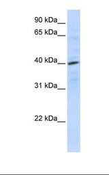 CXCR4 Antibody - 721_B cell lysate. Antibody concentration: 1.0 ug/ml. Gel concentration: 12%.  This image was taken for the unconjugated form of this product. Other forms have not been tested.