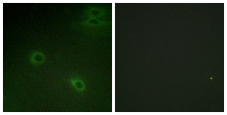 CXCR4 Antibody - Immunofluorescence analysis of HeLa cells, using CXCR4 (Phospho-Ser339) Antibody. The picture on the right is blocked with the phospho peptide.