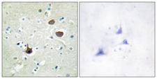 CXCR4 Antibody - Immunohistochemistry analysis of paraffin-embedded human brain, using CXCR4 (Phospho-Ser339) Antibody. The picture on the right is blocked with the phospho peptide.