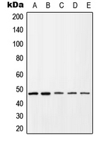 CXCR4 Antibody - Western blot analysis of CD184 (pS339) expression in HEK293T colchicine-treated (A); HL60 (B); Jurkat (C); mouse spleen (D); rat spleen (E) whole cell lysates.
