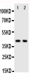 CXCR5 Antibody - Anti-CXCR5 antibody, Western blotting Lane 1: Rat Spleen Tissue LysateLane 2: HELA Cell Lysate