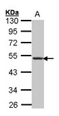 CXCR5 Antibody - Sample (30 ug of whole cell lysate). A: Hep G2. 10% SDS PAGE. CXCR5 antibody diluted at 1:1000. 