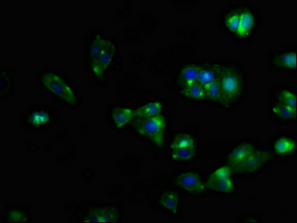 CXCR5 Antibody - Immunofluorescent analysis of HepG2 cells at a dilution of 1:100 and Alexa Fluor 488-congugated AffiniPure Goat Anti-Rabbit IgG(H+L)