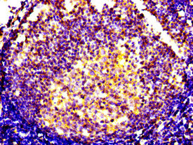 CXCR5 Antibody - Immunohistochemistry image of paraffin-embedded human lymph node tissue at a dilution of 1:100