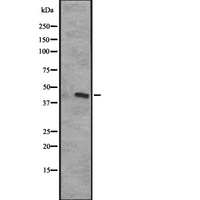 CXCR5 Antibody - Western blot analysis of CXCR5 expression in HeLa cells lysate. The lane on the left is treated with the antigen-specific peptide.