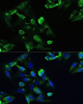 CXCR5 Antibody - Immunofluorescence analysis of U2OS cells using CXCR5 Polyclonal Antibody at dilution of 1:100.Blue: DAPI for nuclear staining.