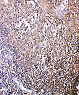 CXCR6 Antibody - CXCR6 antibody. IHC(P): Human Tonsil Tissue.