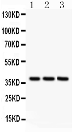 CXCR6 Antibody - Anti-Bonzo antibody, Western blotting All lanes: Anti Bonzo at 0.5ug/ml Lane 1: HELA Whole Cell Lysate at 40ugLane 2: JURKAT Whole Cell Lysate at 40ugLane 3: MCF-7 Whole Cell Lysate at 40ugPredicted bind size: 39KD Observed bind size: 39KD